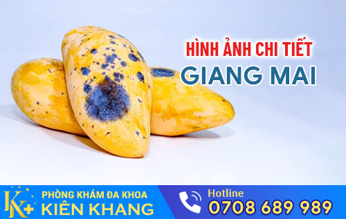 hinh anh chi tiet benh giang mai