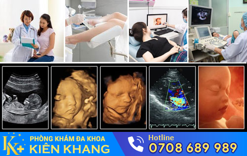 Phòng Khám Đa Khoa Kiên Khang chuyên khám sản phụ khoa uy tín