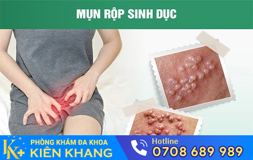 Hình ảnh cho virus HSV