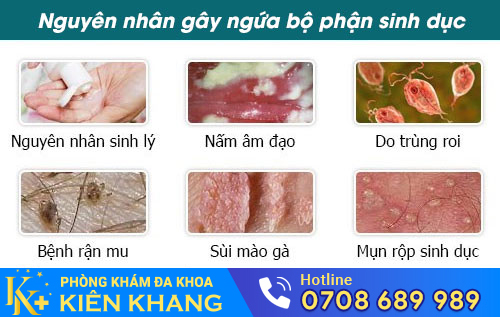 Nguyên nhân gây ngứa bộ phận sinh dục