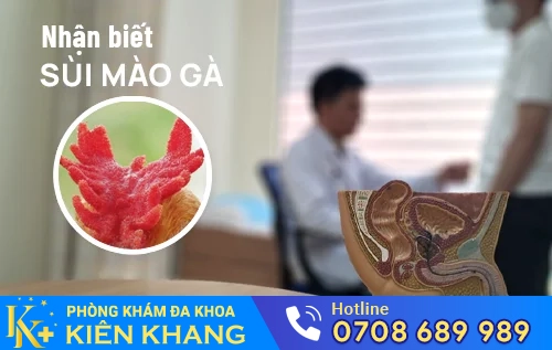 nhan biet sui mao ga tren tung bo phan co the