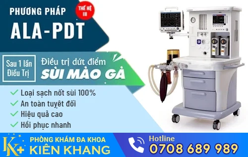 phuong phap dot dien cai tien moi dieu tri sui mao ga