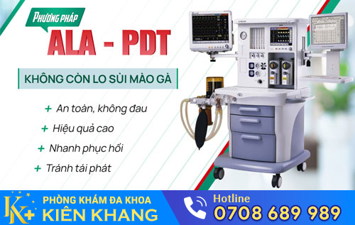 Phương pháp ALA -PDT