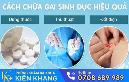 Phương pháp hỗ trợ điều trị gai sinh dục