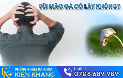 sui mao ga co lay khong khong