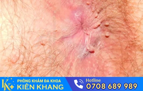 sui mao ga o hau mon