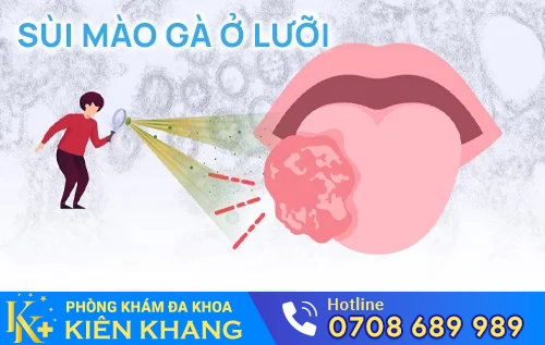 sui mao ga o luoi