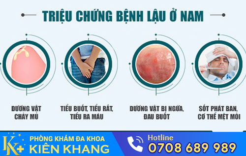 Triệu chứng bệnh lậu ở nam