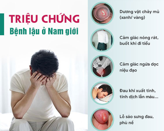 Triệu chứng bệnh lậu ở nam giới