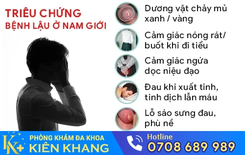trieu chung benh lau o nam gioi
