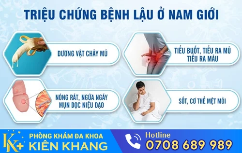 trieu chung benh lau o nam gioi
