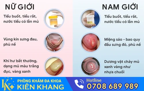 trieu chung benh lau o nam va nu