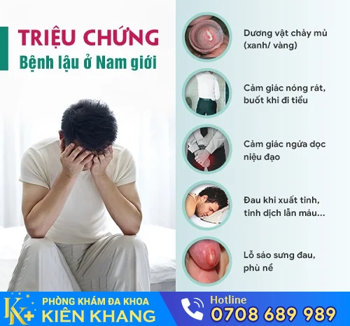 trieu chung lau o nam gioi