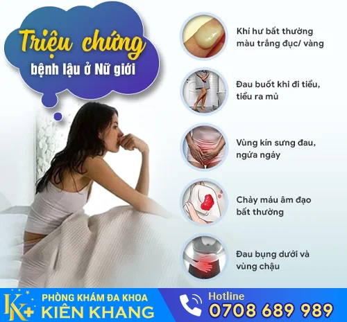 trieu chung lau nu gioi