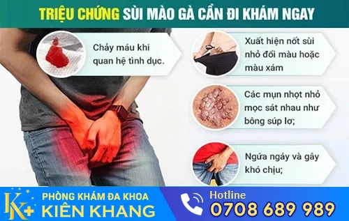 trieu chung sui mao ga can di kham ngay