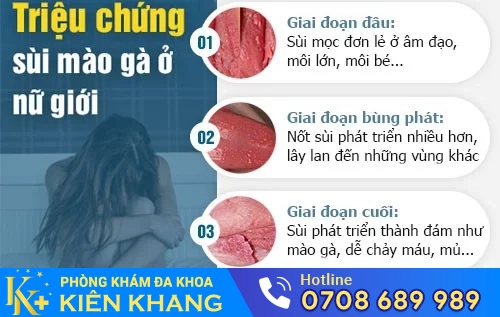 trieu chung sui mao ga o nu gioi