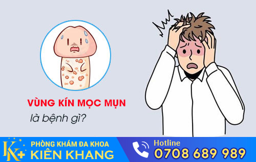 Vùng kín mọc mụn là bệnh gì?