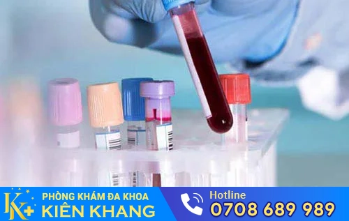 xet nghiem benh xa hoi