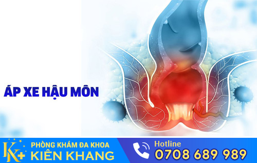 Apxe hậu môn