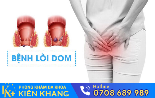 Bệnh lòi dom