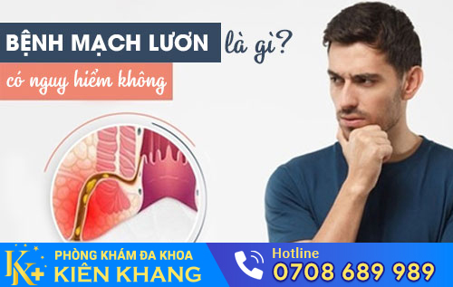 Bệnh mạch lươn là gì?