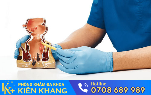bệnh về hậu môn, trực tràng