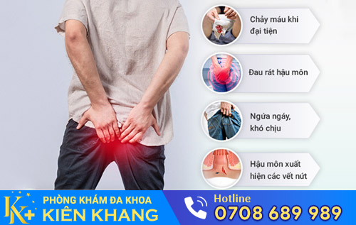 Biểu hiện bệnh nứt kẽ hậu môn