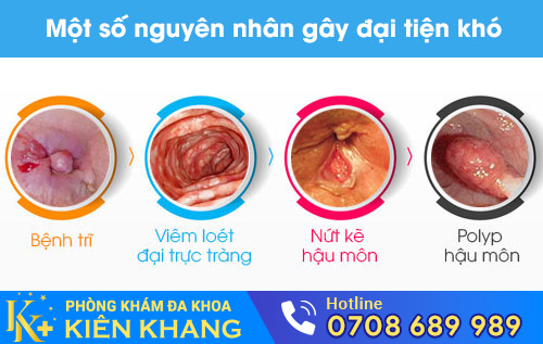 Một số nguyên nhân gây đại tiện khó