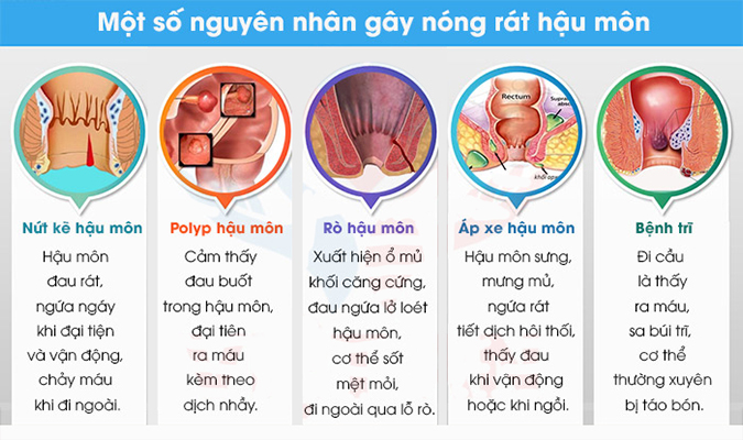 Một số nguyên nhân gây nóng rát hậu môn