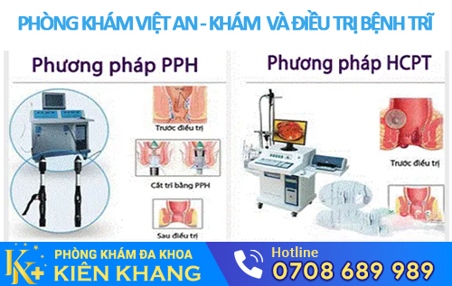 HCPT và PPH là 2 phương pháp chữa trĩ vượt trội nhất hiện nay