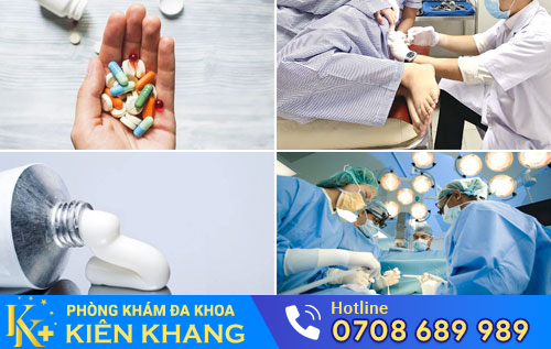 Một số phương pháp điều trị viêm hậu môn