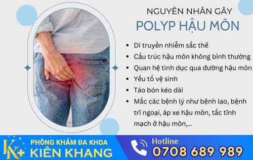 Nguyên nhân polyp hậu môn