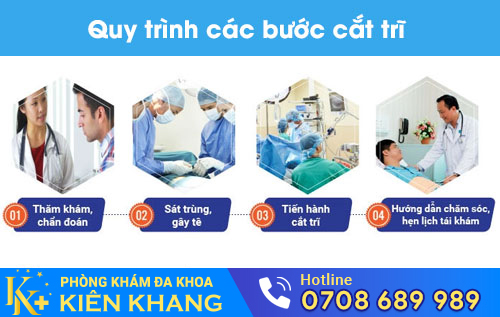 Quy trình cắt trĩ