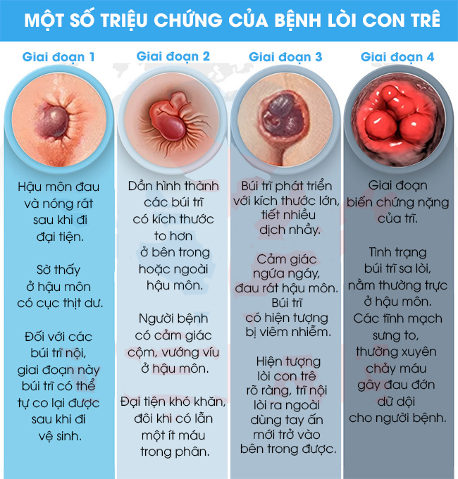 Triệu chứng bệnh lòi con trê