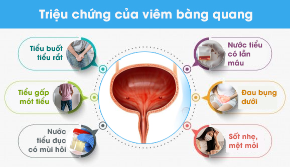 Triệu chứng bệnh viêm bàng quang