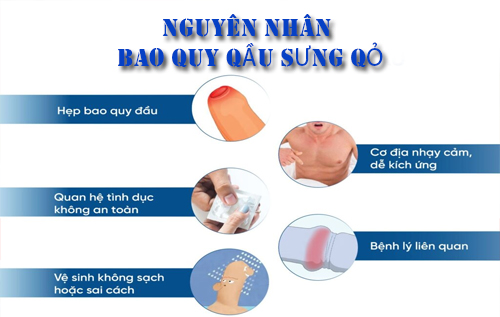 Lý do khiến bao quy đầu sưng đỏ