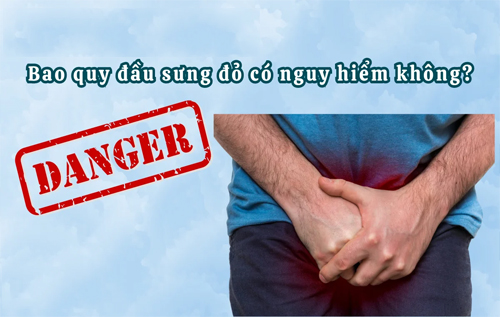 Bao quy đầu sưng đỏ có nguy hiểm không?