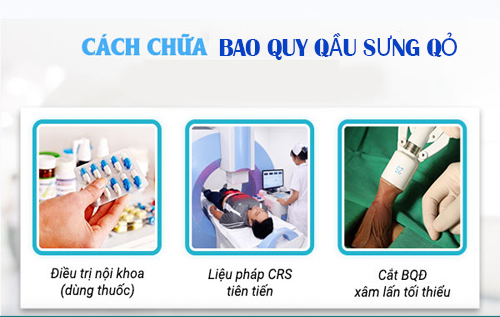 Phương pháp điều trị bao quy đầu sưng đỏ hiệu quả tại Phòng khám Kiên Khang