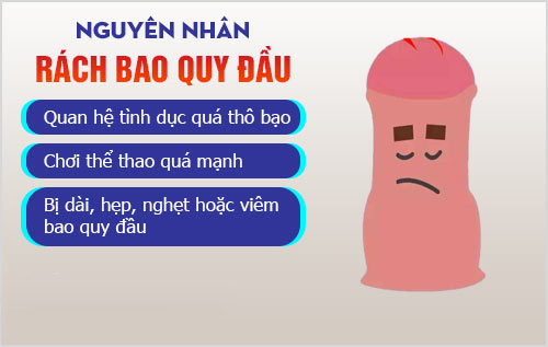 Nguyên nhân gây rách bao quy đầu