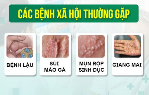 Các bệnh xã hội phổ biến hiện nay