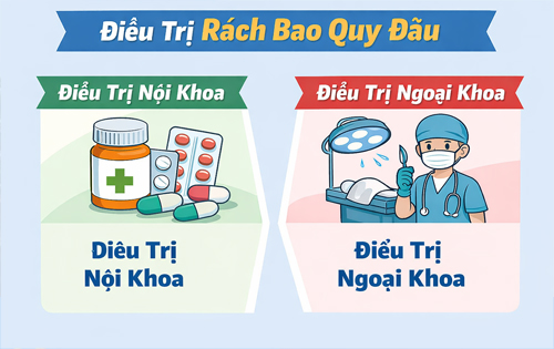 Cách xử lý bị rách bao quy đầu khi quan hệ an toàn, không đau