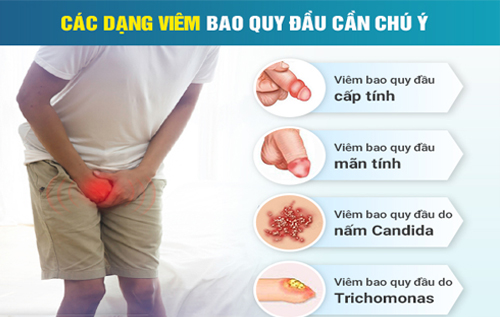 Các dạng viêm bao quy đầu ở nam giới