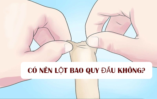 Có nên lột bao quy đầu không?