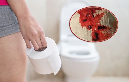 Đi đại tiện ra máu có sao không?