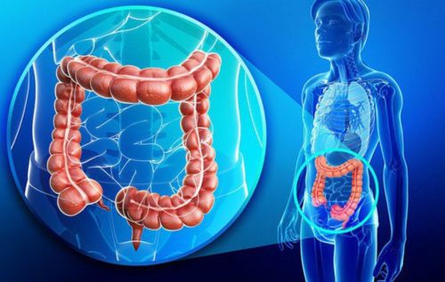 Đi ngoài ra máu đỏ tươi do Polyp đại trực tràng