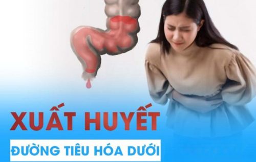 Đi cầu ra máu do xuất huyết đường tiêu hóa