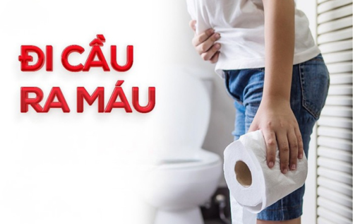 Hiện tượng đi cầu ra máu là gì?