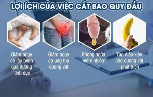 Một số lợi ích khi cắt bao quy đầu