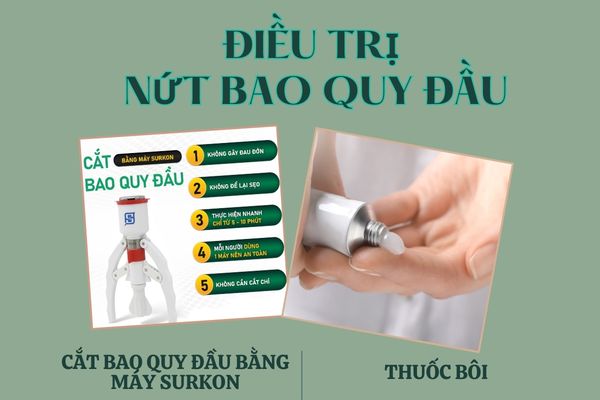 Cách điều trị nứt bao quy đầu an toàn tại Phòng Khám Kiên Khang Đồng Nai