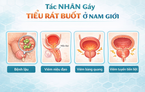 Đi tiểu rát buốt dấu hiệu bệnh lý